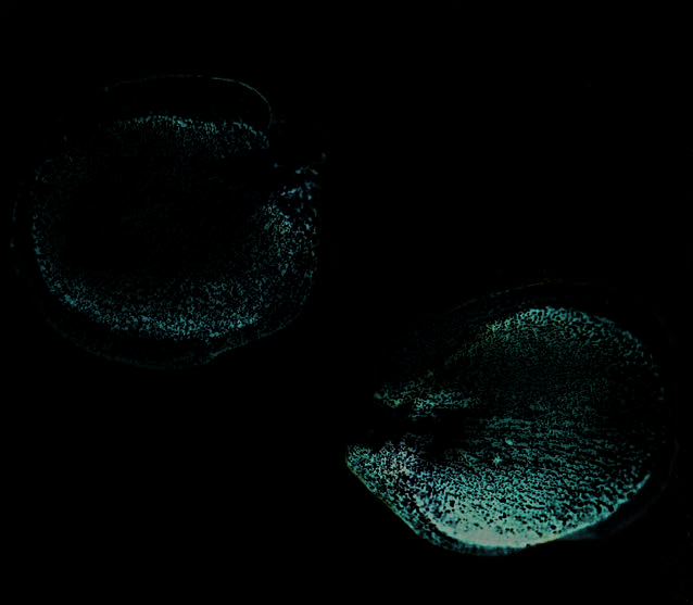 Seeds of Berteroa incana